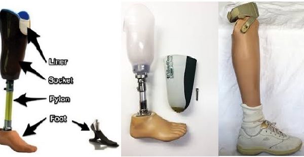 پای مصنوعی زیر زانو