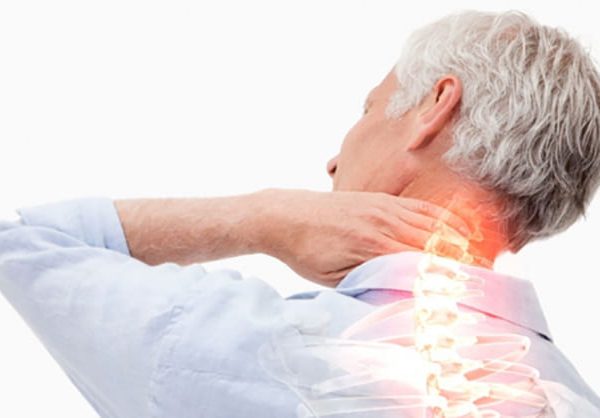 درمان آرتروز گردن