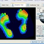 درمان و جلوگیری از زخم دیابت با استفاده از کفش و کفی طبی