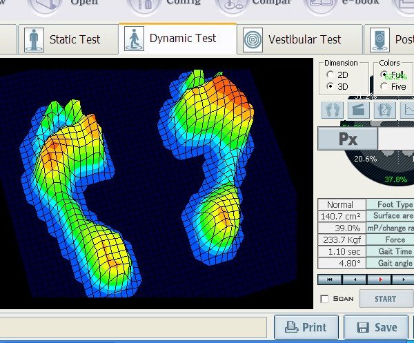درمان و جلوگیری از زخم دیابت با استفاده از کفش و کفی طبی